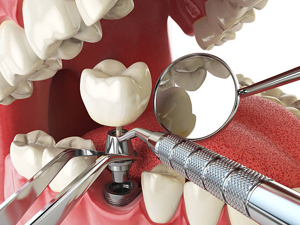 Best Emergency Dental Surgery in Savanna, IL